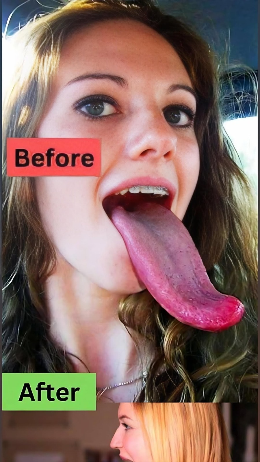 The Abnormality of the Girl’s Tongue: Analysis and Causes